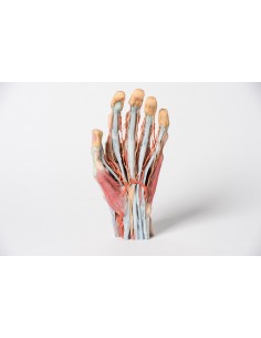 Disección de la mano Erler... 2