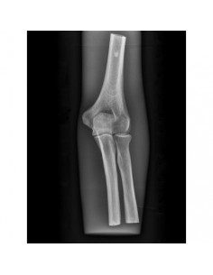 Simulador de radiología -...