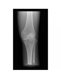 Simulador para radiología -...