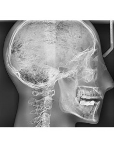 Simulador para radiología -...