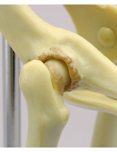 Esqueleto de la pelvis de...