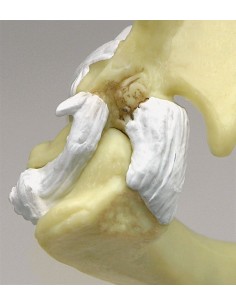 Articulación del hombro y...