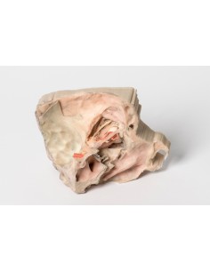 Órbita medial - Erler... 2