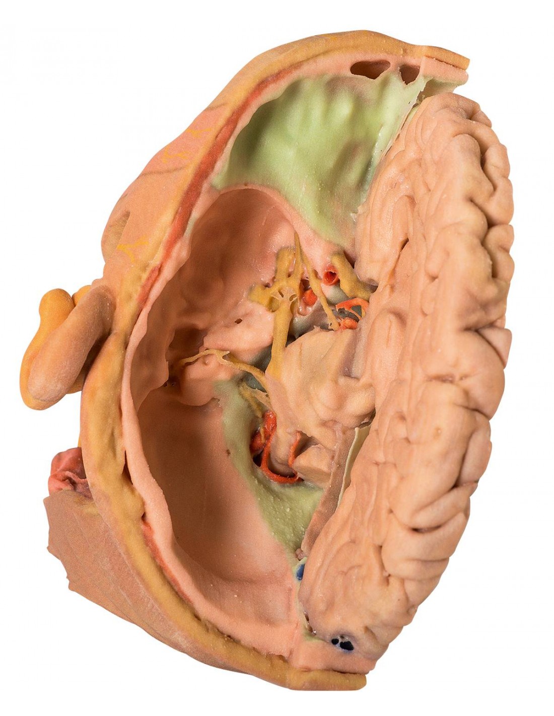 Disección de cabeza y cuello - Erler... Disección de cabeza y cuello - Erler...