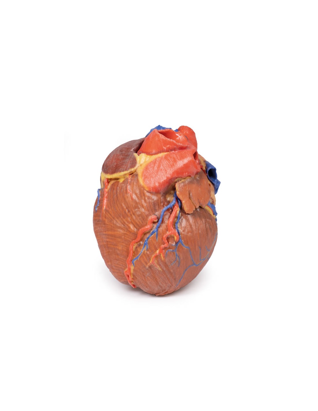 Corazón completo  - Erler Zimmer 3D... Corazón completo  - Erler Zimmer 3D...