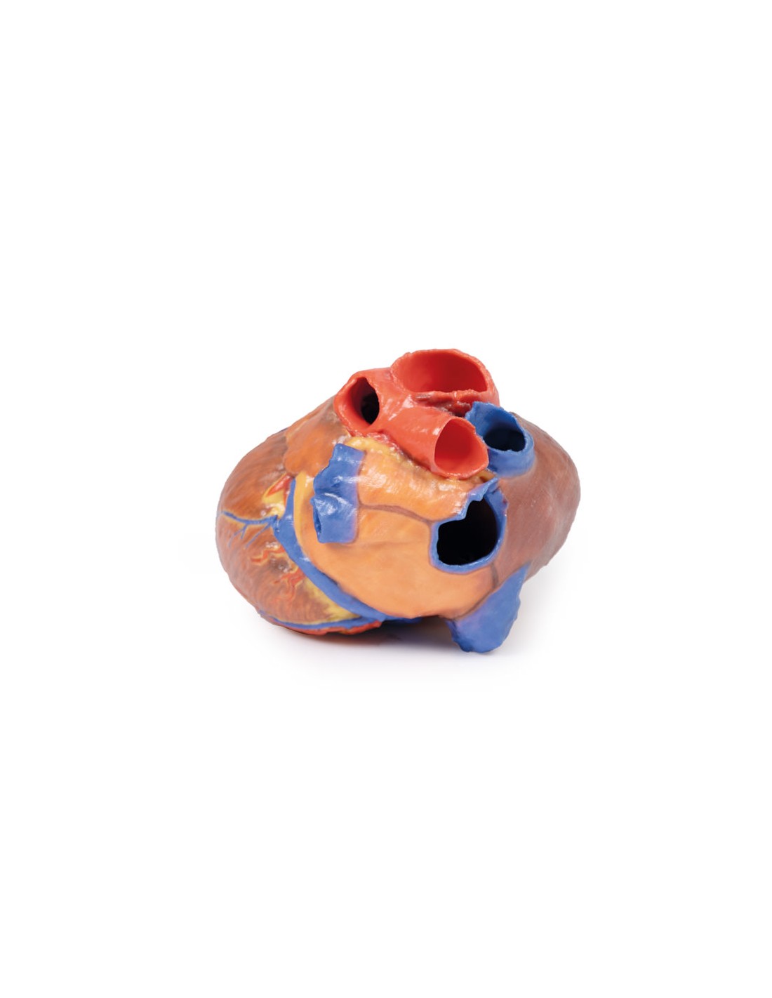 Corazón completo  - Erler Zimmer 3D... Corazón completo  - Erler Zimmer 3D...