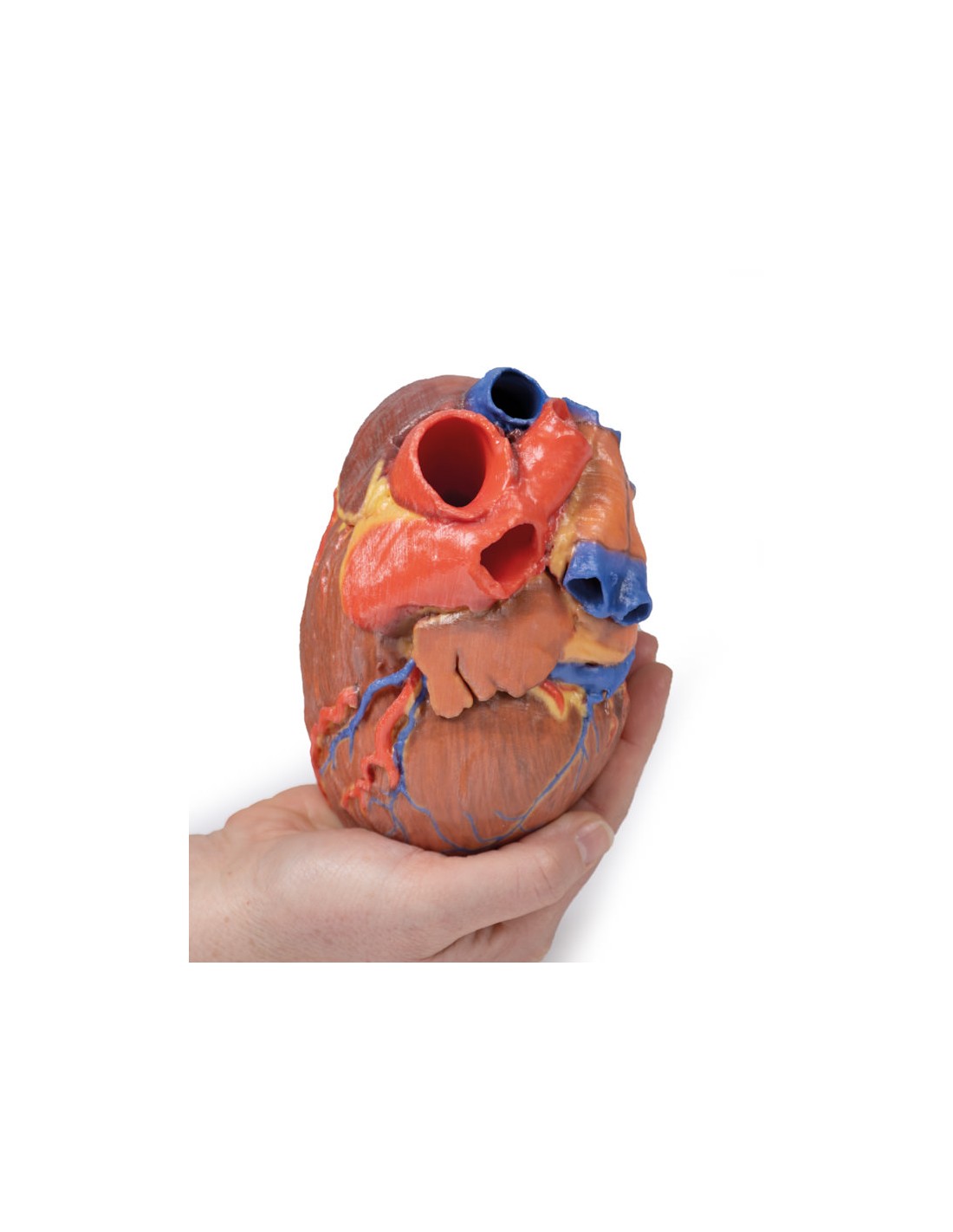 Corazón completo  - Erler Zimmer 3D... Corazón completo  - Erler Zimmer 3D...