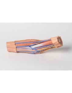 Fosa del codo Erler Zimmer... 2