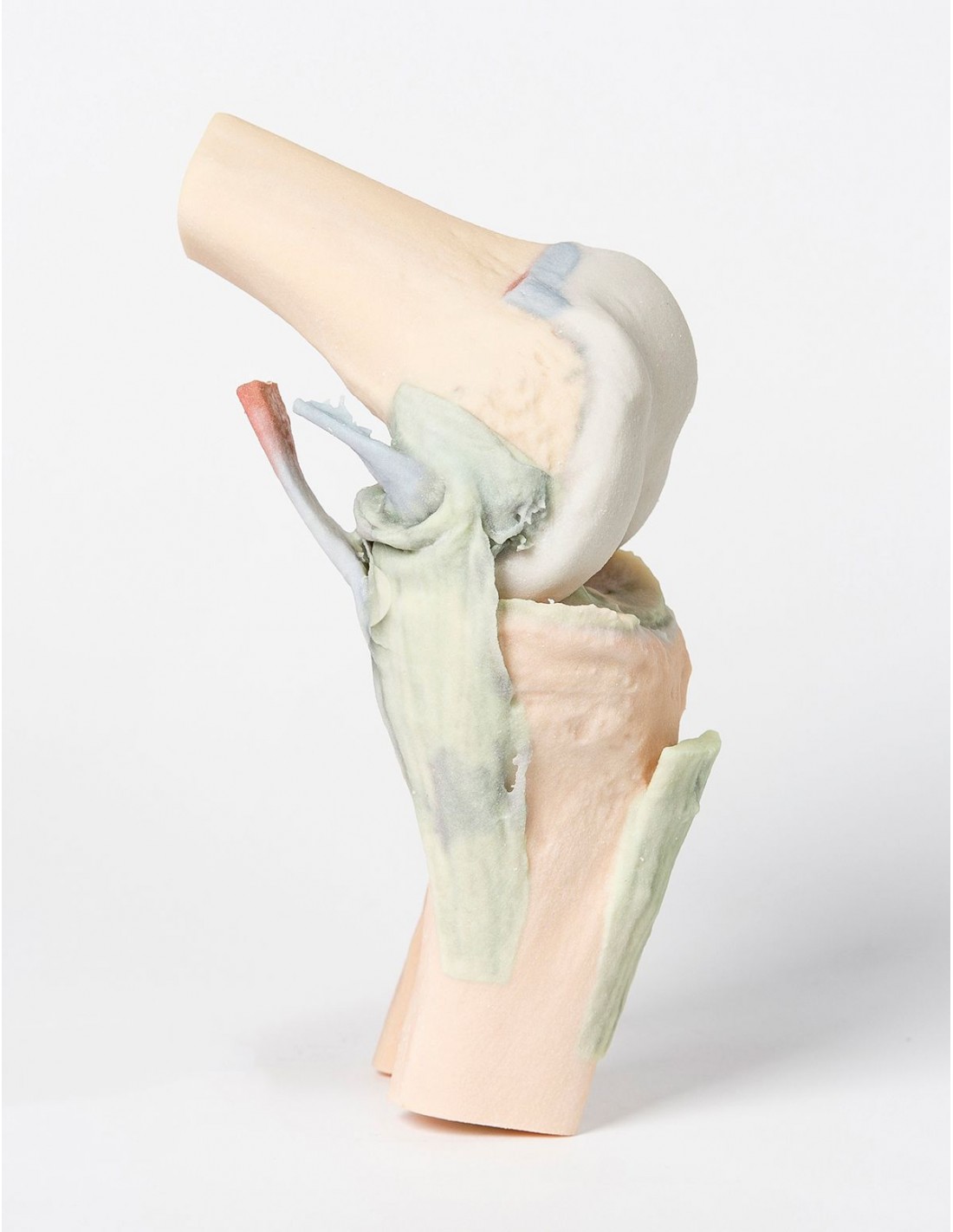 Articulación de la rodilla,... Articulación de la rodilla,...