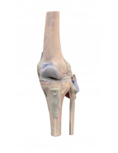 Articulación de la rodilla,...