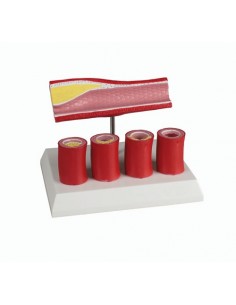 Modelo anatómico arterial...