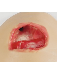 Simulador para terapia de... 2