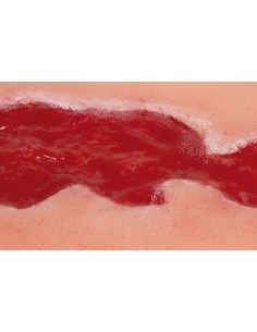 Moulage de herida de úlcera... 2