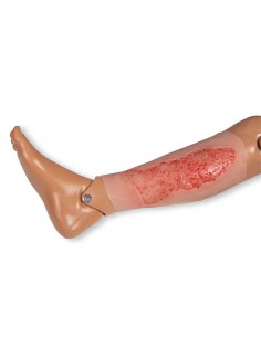 Moulage de herida por... 2