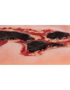 Moulage de herida ulcerosa... 2