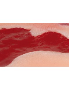 Moulage de herida de úlcera... 2