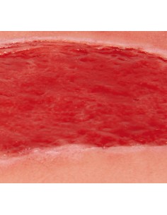Moulage de herida de úlcera... 2