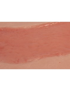 Moulage de herida de úlcera... 2