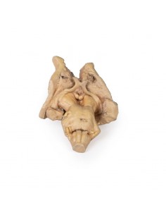 Tronco cerebral,... 2