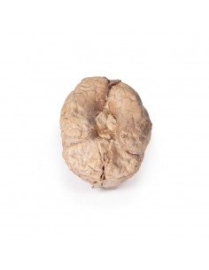 Cerebro humano - Erler... 2