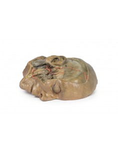 Sección sagital de la... 2