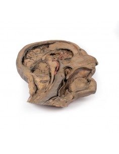 Corte parasagital de cabeza...