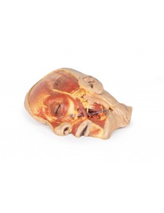 Disección superficial de la... 2