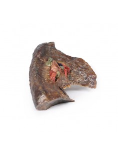 Hilio del pulmón izquierdo...