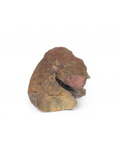 Sección de pulmón, sin...