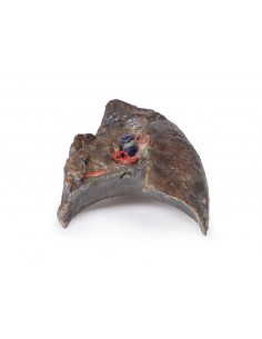 Disección del hilio...