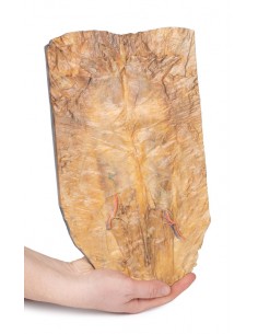 Pared abdominal interna -... 2