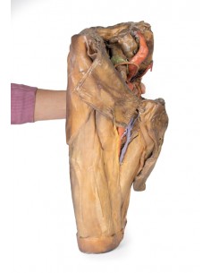 Disección de hemipelvis y... 2
