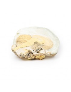 Adenoma pituitario - Erler...