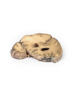 Adenocarcinoma metastásico... 2
