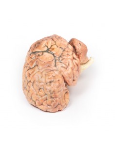 Craneofaringioma - Erler... 2