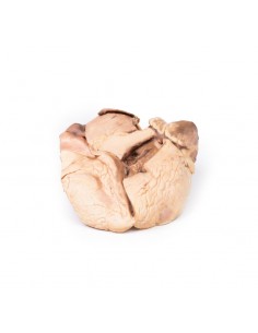 Endocarditis reumática -... 2