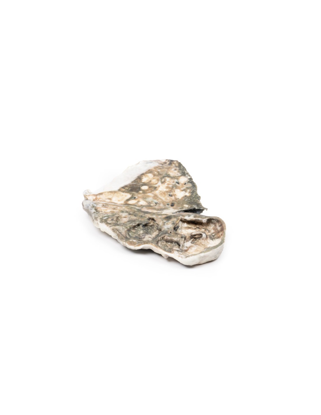 Tuberculosis fibrocaseosa - Erler... Tuberculosis fibrocaseosa - Erler...