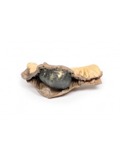 Íleo con piedras - Erler...