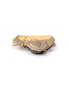 Íleo con piedras - Erler... 2