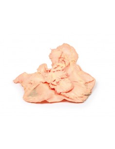 Adenocarcinoma de estómago... 2