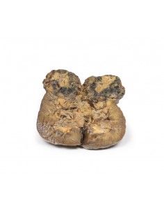 Carcinoma de células...