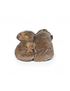 Carcinoma de células... 2