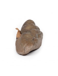 Carcinoma papilar de... 2