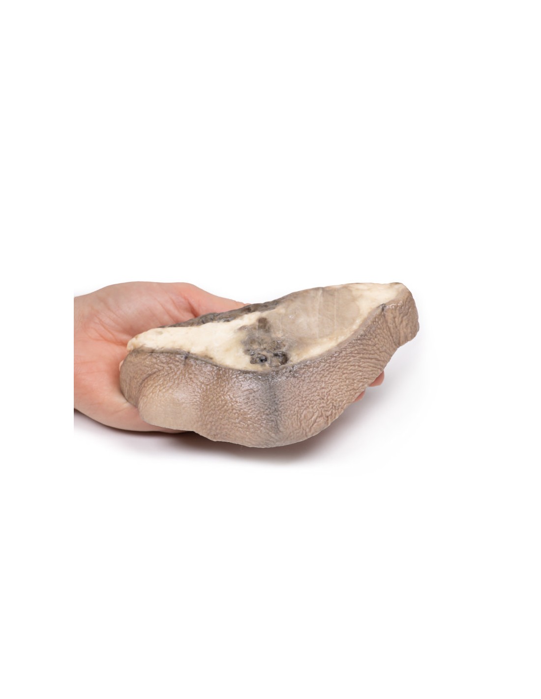 Cáncer de mama - Erler Zimmer 3D... Cáncer de mama - Erler Zimmer 3D...