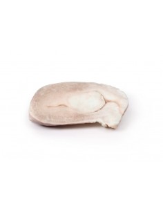 Fibroma uterino - Erler...