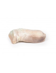 Fibroma uterino - Erler... 2