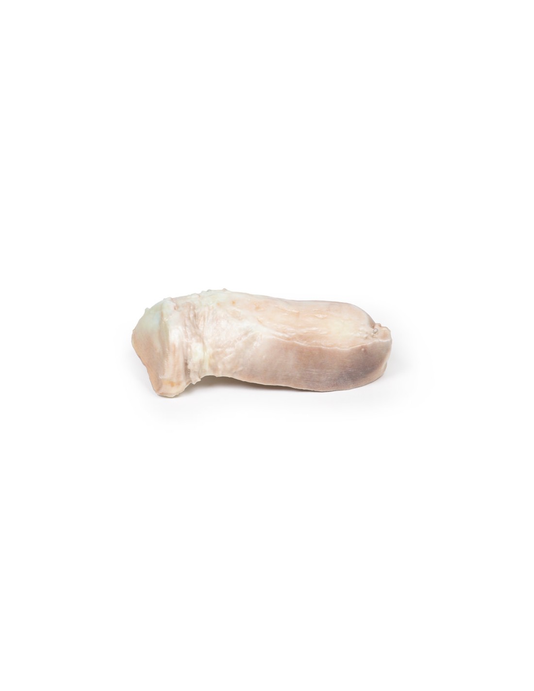 Fibroma uterino - Erler Zimmer 3D... Fibroma uterino - Erler Zimmer 3D...