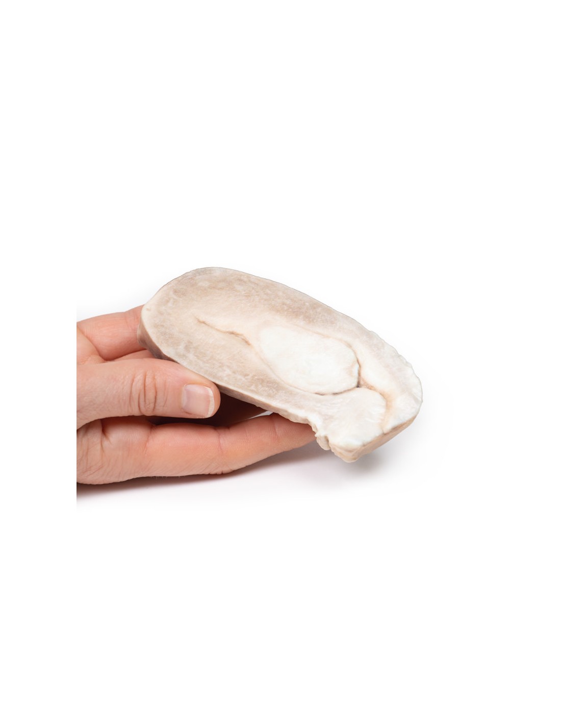 Fibroma uterino - Erler Zimmer 3D... Fibroma uterino - Erler Zimmer 3D...