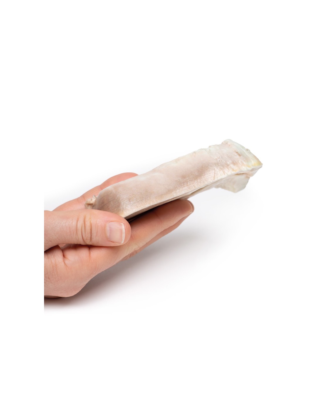 Fibroma uterino - Erler Zimmer 3D... Fibroma uterino - Erler Zimmer 3D...