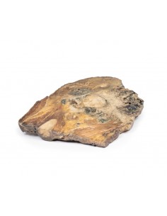 Condrosarcoma de fémur e... 2